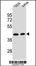 Anti-ADA Mouse Monoclonal Antibody (APC (Allophycocyanin)) [clone: 608CT2.1.3]