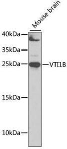 Western blot analysis of extracts of mouse brain, using Anti-VTI1B Antibody (A12064) at 1:1000 dilution. The secondary Antibody was Goat Anti-Rabbit IgG H&L Antibody (HRP) at 1:10000 dilution. Lysates/proteins were present at 25 µg per lane