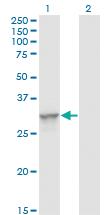 Anti-TOLLIP Mouse Monoclonal Antibody [clone: 1A5-2A3]