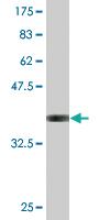 Anti-UBA6 Mouse Monoclonal Antibody [clone: 1D11]