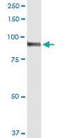 Anti-PWP2 Polyclonal Antibody Pair