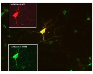 Co-localization of calretinin (green) and visinin (red) in retinal neuron visualized by Immunocytochemistry. Rat retinal primary cells were cultured for 7 days. Image courtesy of QBM Cell Science.