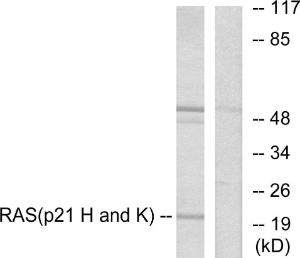 Western blot analysis of lysates from HeLa cells using Anti-RASH Antibody. The right hand lane represents a negative control, where the Antibody is blocked by the immunising peptide