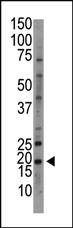 Anti-NME6 Rabbit Polyclonal Antibody