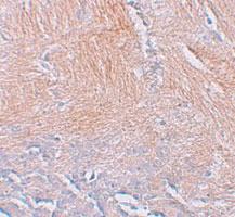 Anti-TFF3 Rabbit Polyclonal Antibody