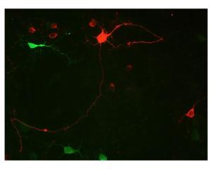 Staining of calretinin (red) and VILIP1 (green) positive neurons by Immunocytochemistry in rat retina culture. Rat retinal primary cells were cultured for 7 days. Image courtesy of QBM Cell Science.