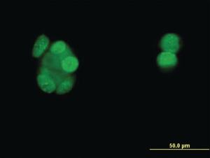 Anti-PGR Mouse Monoclonal Antibody [clone: 3E11]