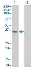 Anti-HEY1 Mouse Monoclonal Antibody [clone: 3B3]