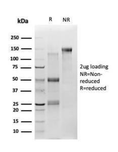 SDS-PAGE analysis of Anti-TSC22D1 Antibody [PCRP-TSC22D1-1A2] under non-reduced and reduced conditions; showing intact IgG and intact heavy and light chains, respectively SDS-PAGE analysis confirms the integrity and purity of the antibody