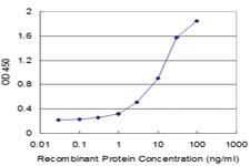 Anti-IL11 Mouse Monoclonal Antibody [clone: 1F1]