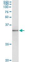 Anti-TOLLIP Mouse Monoclonal Antibody [clone: 1A5-2A3]