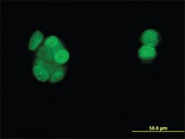 Anti-PGR Mouse Monoclonal Antibody [clone: 3E11]