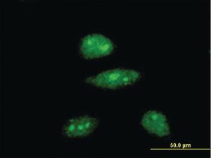 Anti-HEY1 Mouse Monoclonal Antibody [clone: 3B3]