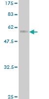 Anti-DUSP4 Mouse Monoclonal Antibody [clone: 3D6-G6]