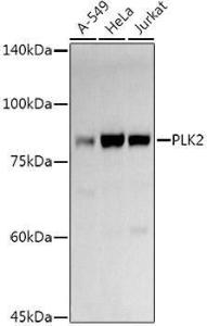 Western blot analysis of extracts of various cell lines, using Anti-PLK2 Antibody (A12065) at 1:1,000 dilution