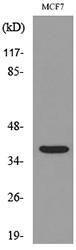 Anti-CD79b Rabbit Polyclonal Antibody