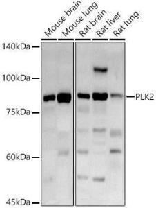 Western blot analysis of extracts of various cell lines, using Anti-PLK2 Antibody (A12065) at 1:1,000 dilution