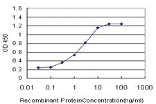 Anti-PGR Mouse Monoclonal Antibody [clone: 3E11]