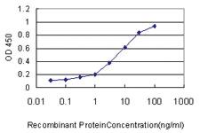 Anti-TOLLIP Mouse Monoclonal Antibody [clone: 1A5-2A3]