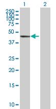 Anti-GTF2H4 Mouse Polyclonal Antibody