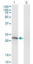 Anti-SSX3 Mouse Monoclonal Antibody [clone: 4A11]