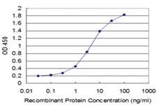 Anti-HEY1 Mouse Monoclonal Antibody [clone: 3B3]