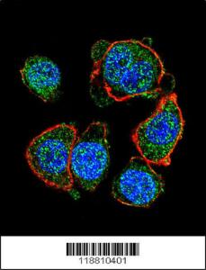 Anti-MITF Rabbit Polyclonal Antibody (AP (Alkaline Phosphatase))