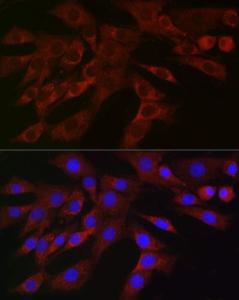 Immunofluorescence analysis of NIH/3T3 cells using Anti-PLK2 Antibody (A12065) at a dilution of 1:100 (40X lens). DAPI was used to stain the cell nuclei (blue)