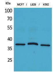 Anti-CD79b Rabbit Polyclonal Antibody