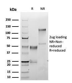 SDS-PAGE analysis of Anti-S100A1 Antibody [S100A1/6374R] under non-reduced and reduced conditions; showing intact IgG and intact heavy and light chains, respectively SDS-PAGE analysis confirms the integrity and purity of the antibody