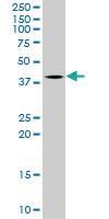 Anti-TFB2M Mouse Monoclonal Antibody [clone: 2E10]