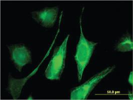 Anti-AK9 Mouse Monoclonal Antibody [clone: 1H8]