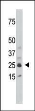 Anti-SULT1C2 Rabbit Polyclonal Antibody (HRP (Horseradish Peroxidase))