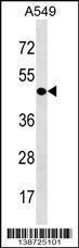 Anti-CDY1 Rabbit Polyclonal Antibody (Biotin)