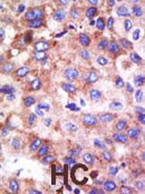 Anti-UBE2G1 Rabbit Polyclonal Antibody (PE (Phycoerythrin))