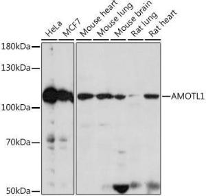 Western blot analysis of extracts of various cell lines, using Anti-Angiomotin like 1 Antibody (A306758) at 1:1,000 dilution. The secondary antibody was Goat Anti-Rabbit IgG H&L Antibody (HRP) at 1:10,000 dilution.