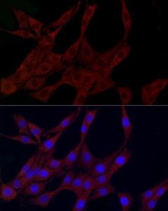 Immunofluorescence analysis of PC-12 cells using Anti-PLK2 Antibody (A12065) at a dilution of 1:100 (40X lens). DAPI was used to stain the cell nuclei (blue)