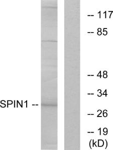 Western blot analysis of lysates from HeLa cells using Anti-SPIN1 Antibody. The right hand lane represents a negative control, where the Antibody is blocked by the immunising peptide