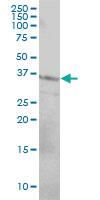 Anti-CD79B Mouse Monoclonal Antibody [clone: 4E10-2A10]