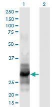 Anti-IL12A Mouse Monoclonal Antibody [clone: 1A6]