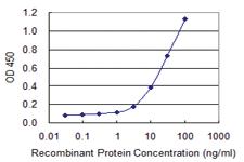 Anti-SSX3 Mouse Monoclonal Antibody [clone: 4A11]