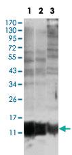 Anti-S100 A10 Mouse Monoclonal Antibody [clone: 4E7E10]