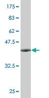 Anti-NEUROG3 Mouse Monoclonal Antibody [clone: 4F6]