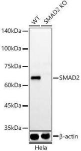 Anti-Smad2 Rabbit Monoclonal Antibody [clone: ARC57635]