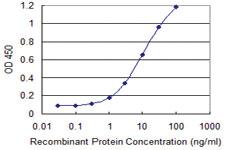 Anti-TKTL1 Mouse Monoclonal Antibody [clone: 1D6]