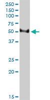 Anti-TFB2M Mouse Monoclonal Antibody [clone: 2E10]