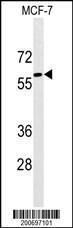 Anti-Fetoprotein Mouse Monoclonal Antibody (PE (Phycoerythrin)) [clone: 143CT50.11.8]