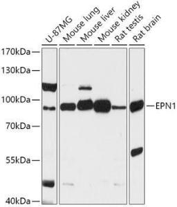 Western blot analysis of extracts of various cell lines, using Anti-Epsin 1 Antibody (A306760) at 1:1000 dilution