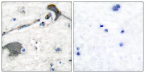 Immunohistochemical analysis of paraffin-embedded human brain tissue using Anti-RASH Antibody. The right hand panel represents a negative control, where the Antibody was pre-incubated with the immunising peptide