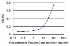 Anti-AK9 Mouse Monoclonal Antibody [clone: 1H8]